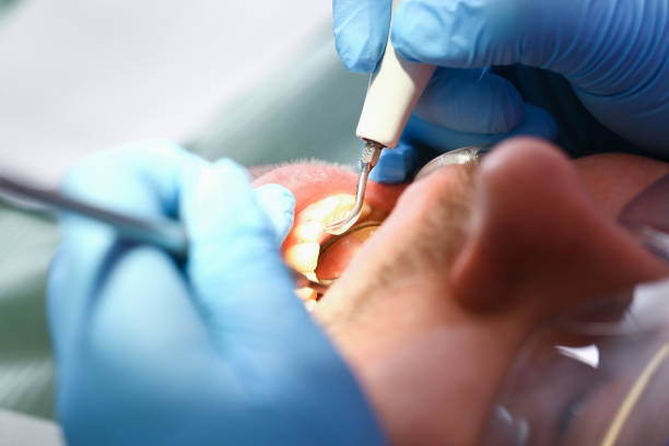 Best Tooth Infection Emergency Dentist  in Orion, IL